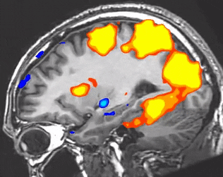 fMRI 扫描效果示意图